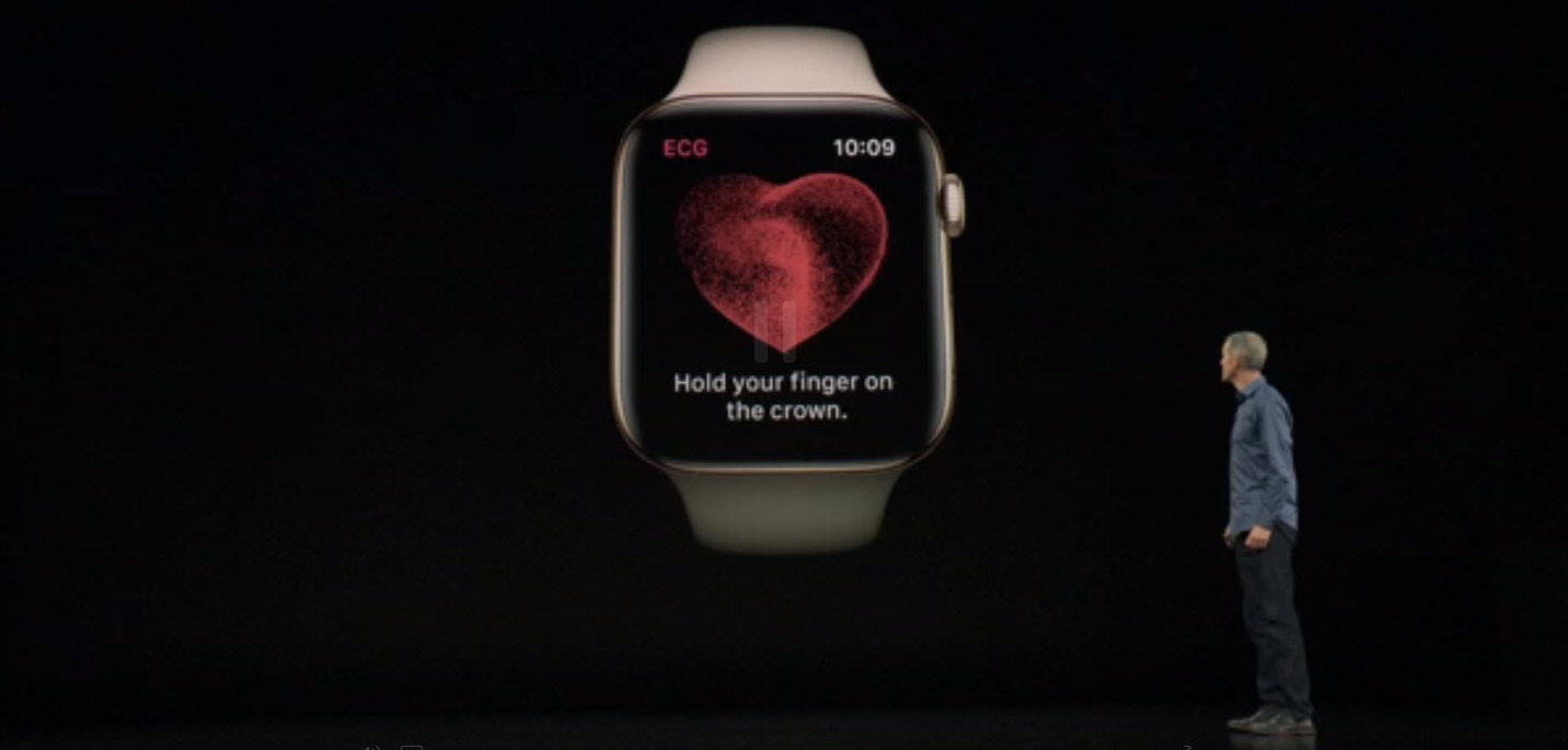 Pýtali sme sa špecialistov: Naozaj môžu nové hodinky Apple Watch zmerať a dobre vyhodnotiť EKG?